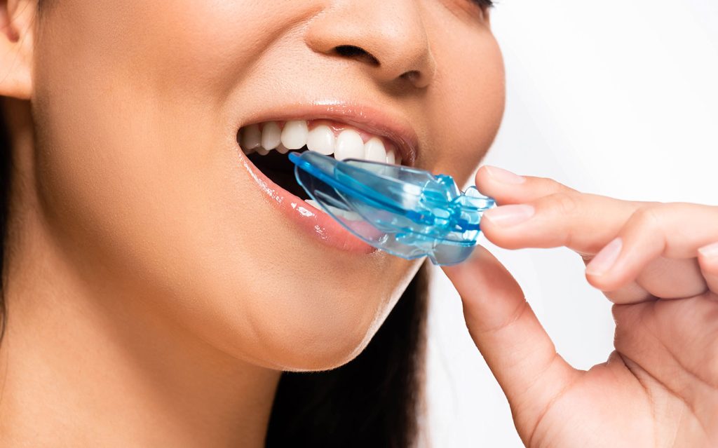 Woman Holding Dental Mouth Guard