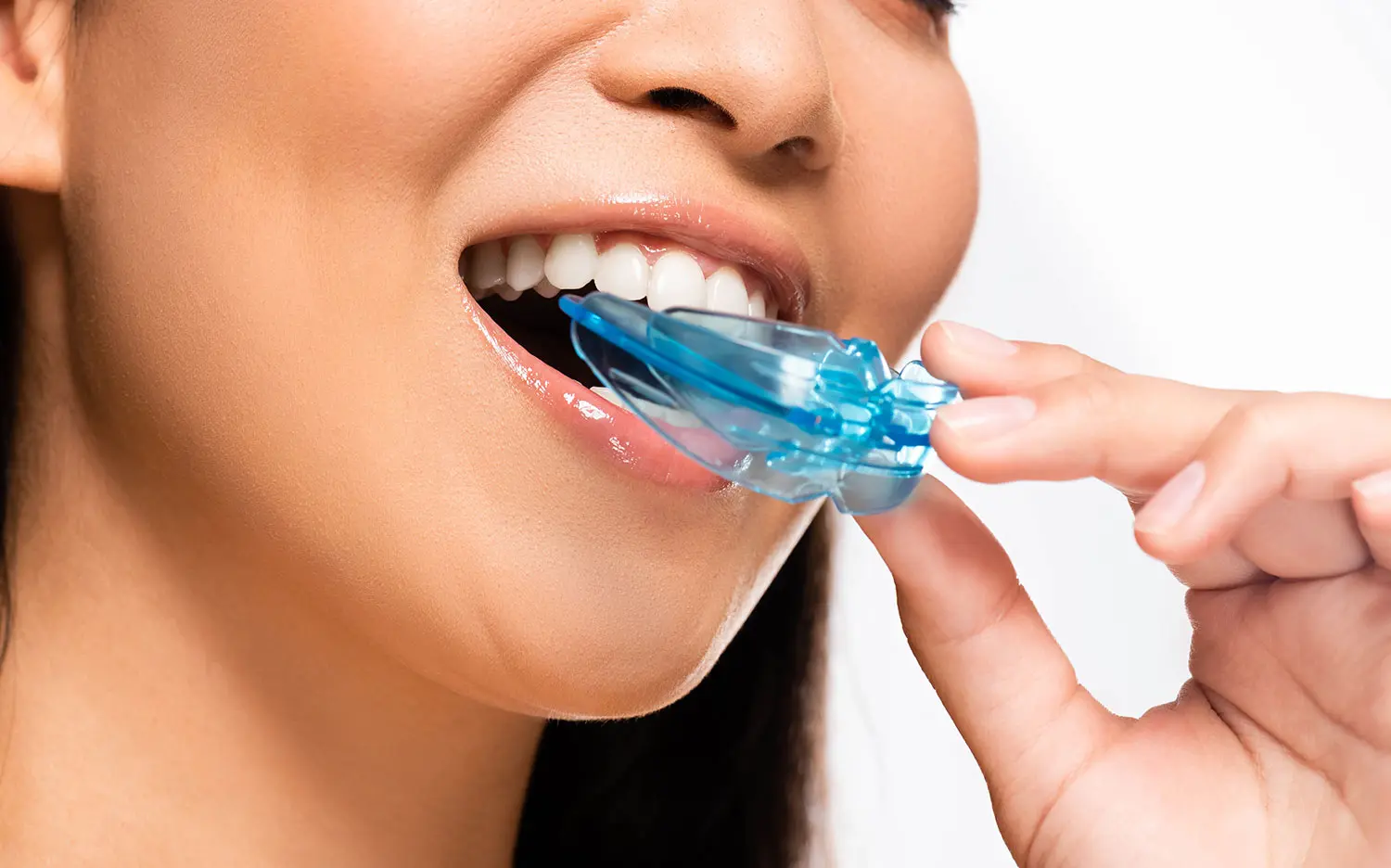 Woman Holding Dental Mouth Guard